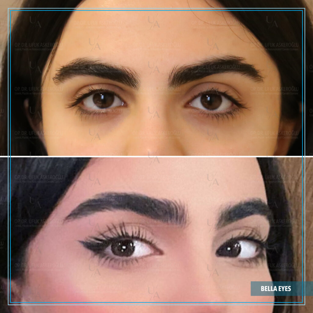 Bella Eyes kalıcı mı Bella Eyes kalıcı mı