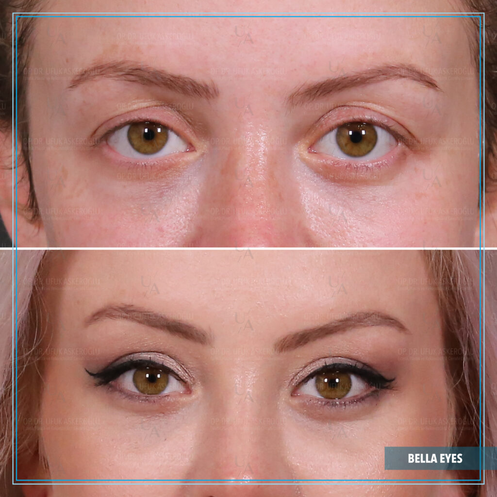 Bella Eyes nasıl yapılır? Bella Eyes nasıl yapılır?