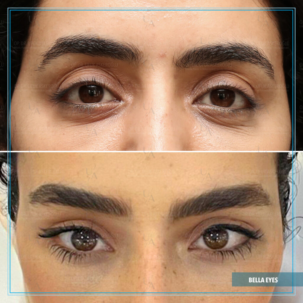 Bella Eyes nasıl yapılır? Bella Eyes nasıl yapılır?