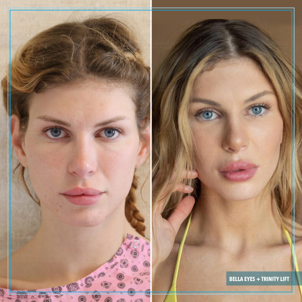 Bella Eyes nasıl yapılır? Bella Eyes nasıl yapılır?