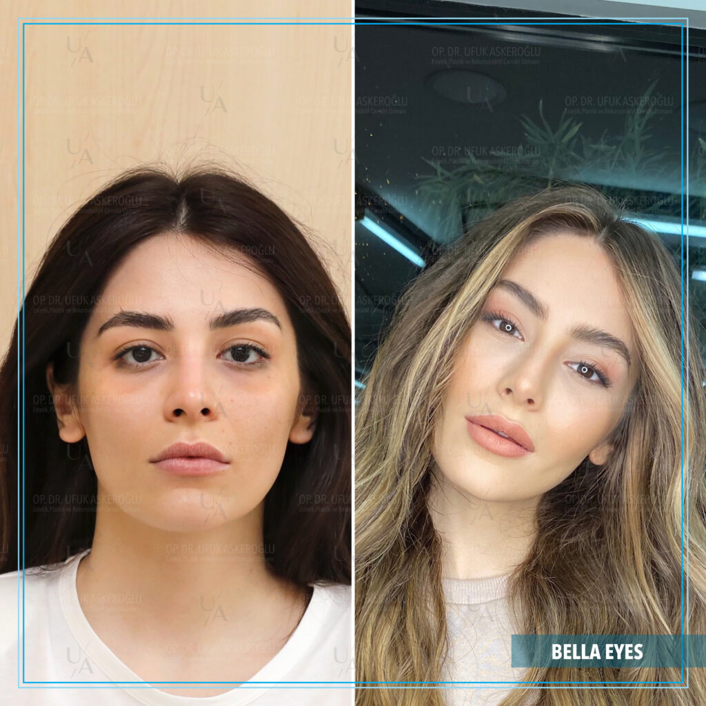 Bella Eyes kalıcı mı Bella Eyes kalıcı mı