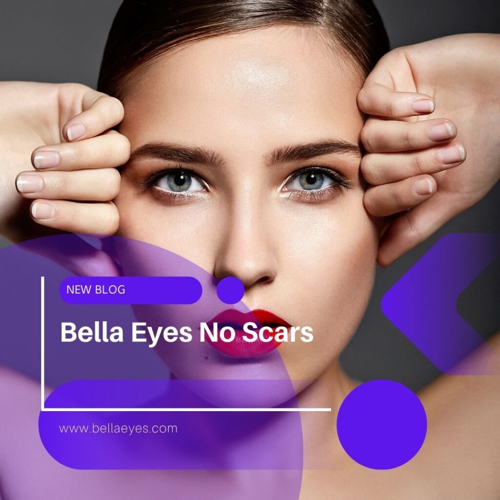 Bella Eyes No Scars