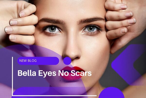 Bella Eyes No Scars