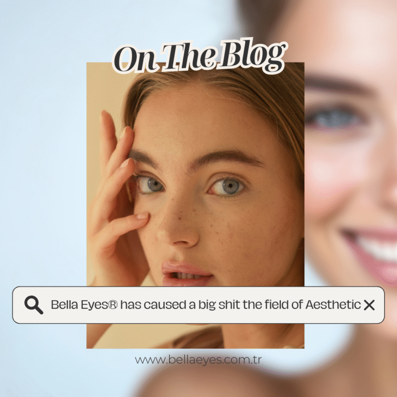Bella Eyes Aesthetic Shift
