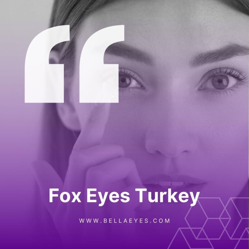 Fox Eyes Turkey