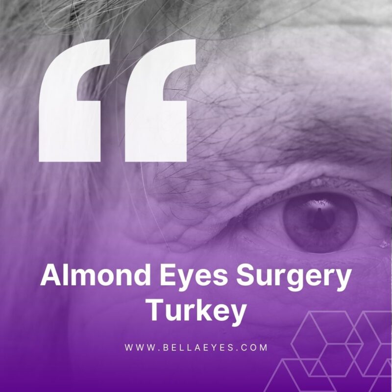 Almond Eyes Surgery Turkey