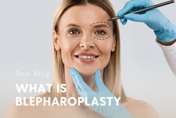 What Is Blepharoplasty