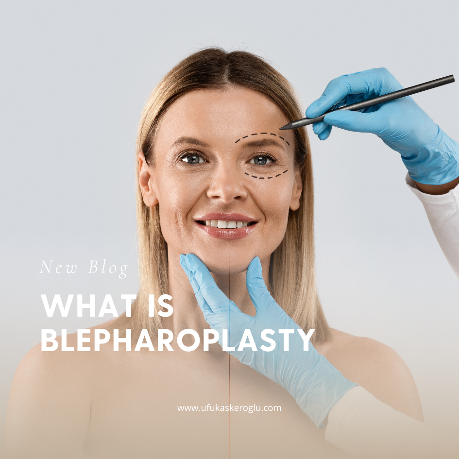 What Is Blepharoplasty