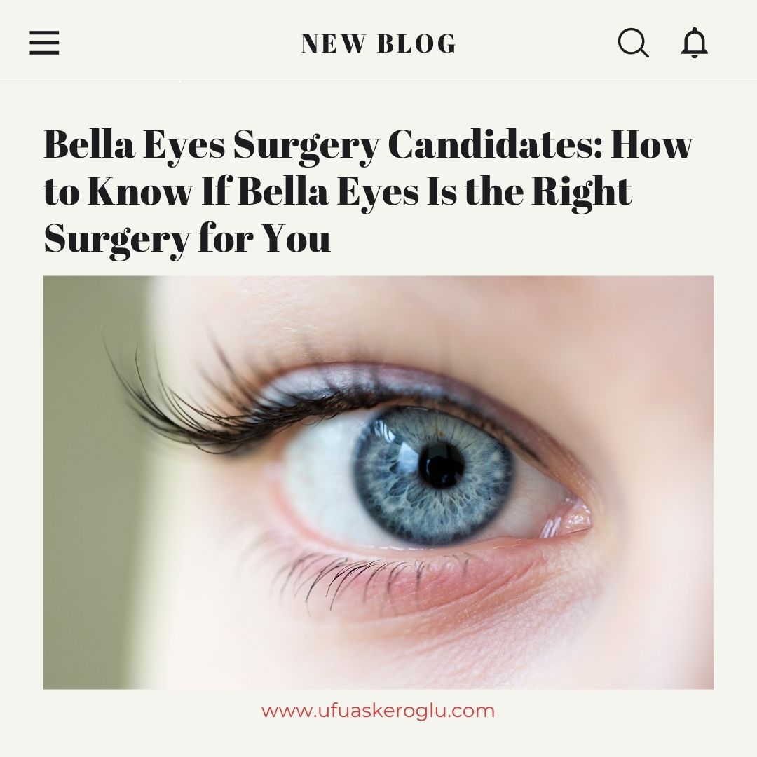 Bella Eyes Surgery Candidates