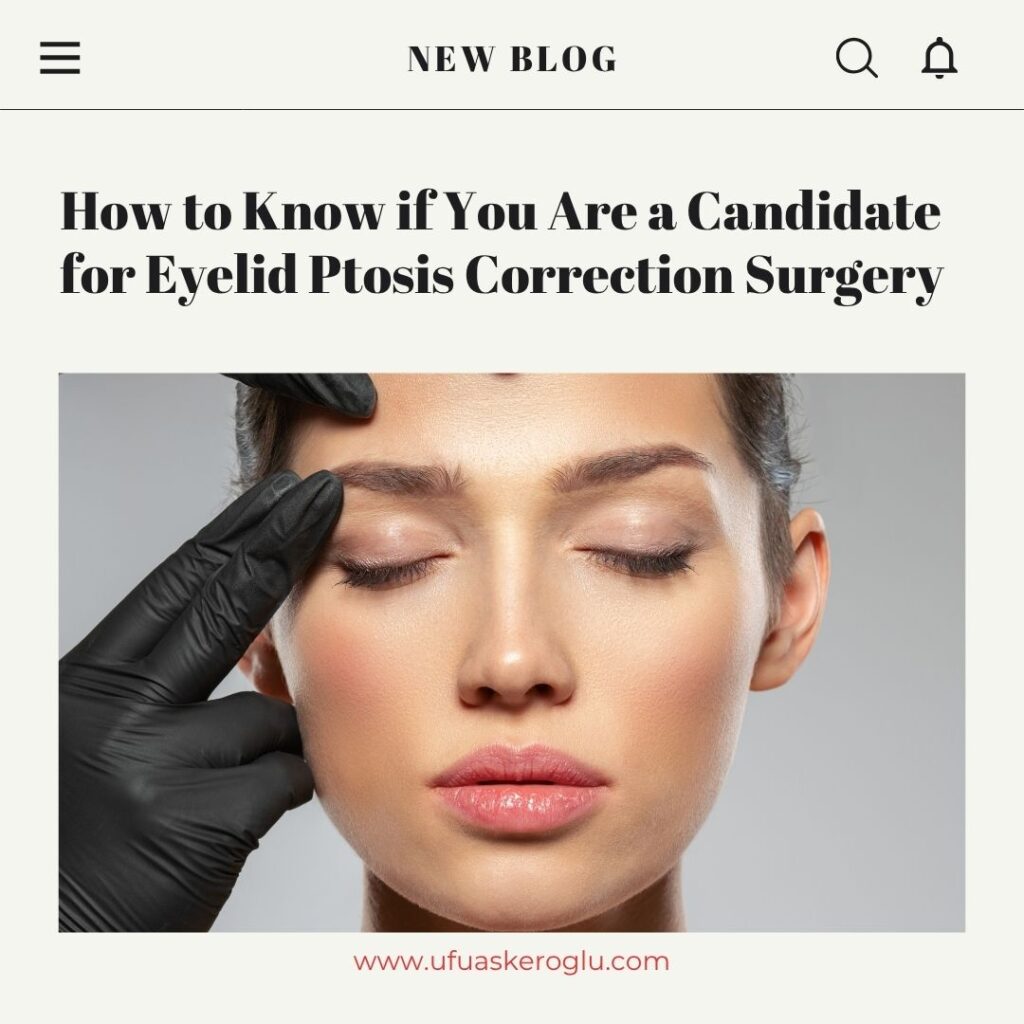 Ptosis Correction Candidates Turkey