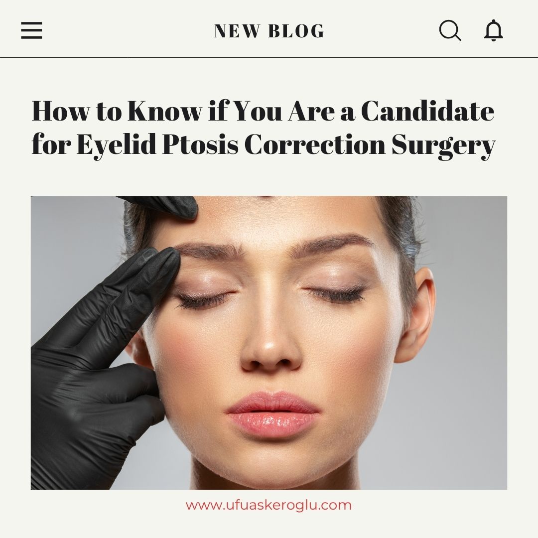 Ptosis Correction Candidates Turkey