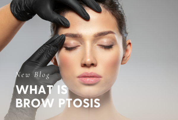 What Is Brow Ptosis