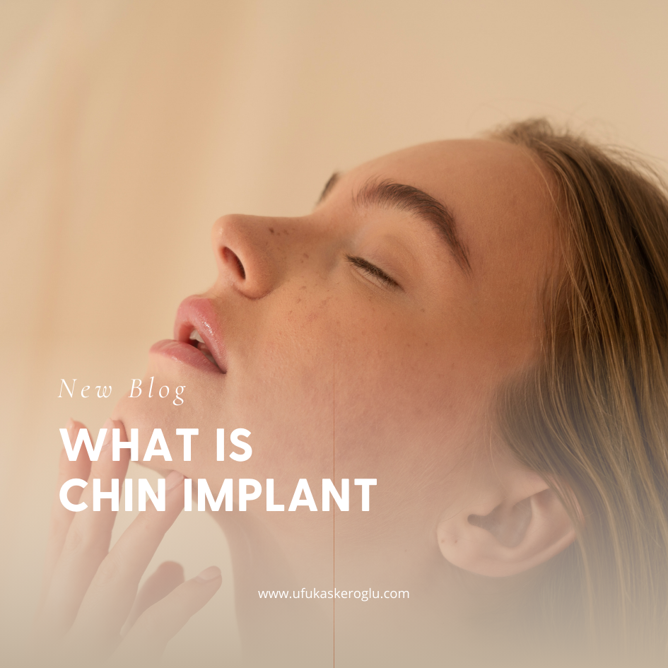 What Is Chin Implant