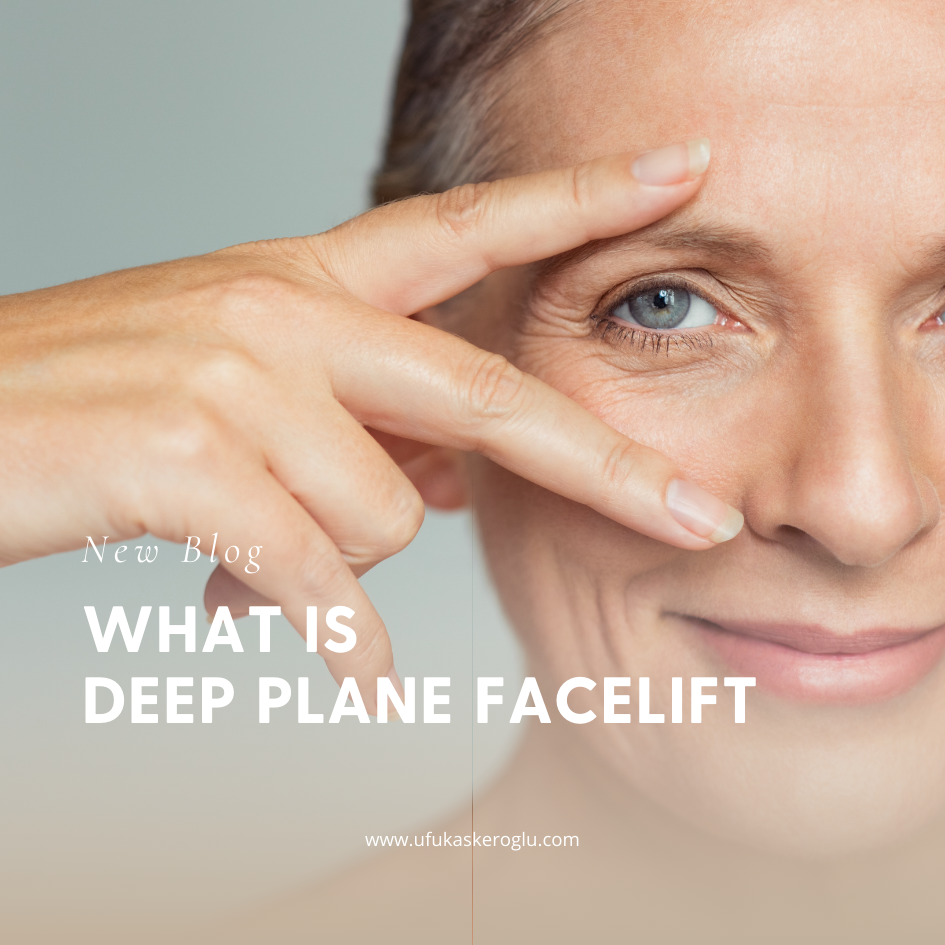 What Is Deep Plane Facelift