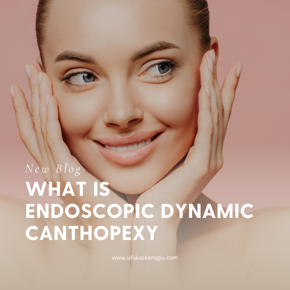 What Is Endoscopic Dynamic Canthopexy